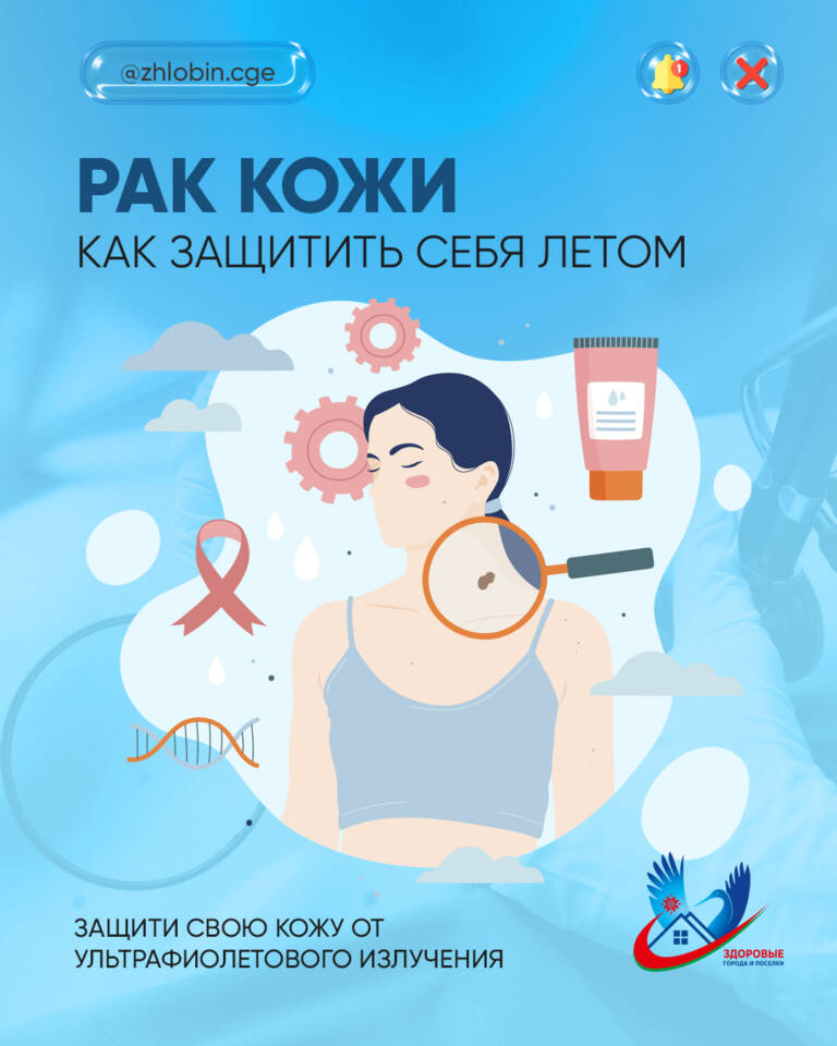 Профилактика рака кожи: актуальные советы для лета в Беларуси.